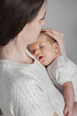 Annemden yeni doğmuş. Atopik deri iltihabı olan 1 aylık bebek..