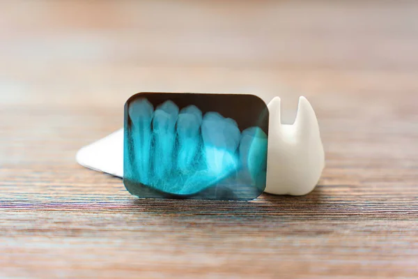 Teeth X-ray and a large white tooth model placed on a wooden background. Dental health, oral hygiene and dentistry related concept.