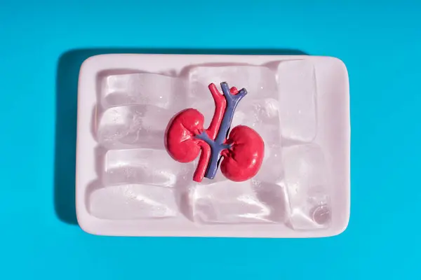 stock image Kidney Model on Ice for Organ Preservation Concept