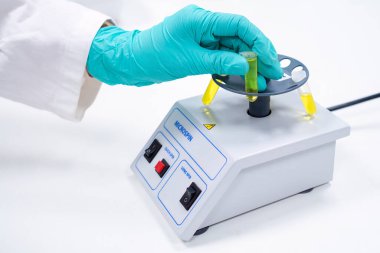 Bilimadamı mikro dönüş için test tüpünü mikro biyolojik analiz için faz ayrıştırmasına koydu 