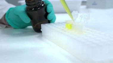 Steril eldivenli laboratuvar çalışanı masada oturarak bilimsel idrar testi yapıyor. Uzman, araştırma için plastik tüplere sarı madde döküyor.