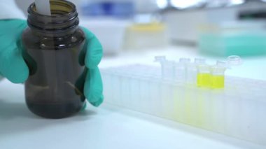 Laboratuvar çalışanı insan idrarına onkoloji testi yapıyor. Lastik eldivenli laboratuar asistanı pipet kullanarak sarı sıvıyı cam tüplere boşaltıyor.