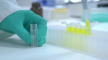 Kimyager, spektrofotometrik analiz için Cuvette 'i otomatik pipetle doldurur. İdrar örneklerinin analizi. 