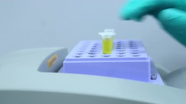 Laboratuvar çalışanı sarı sıvıyla termosakarların içine numune koyar ve karıştırmaya başlar. Mikro kimyasal ya da biyolojik analiz. 
