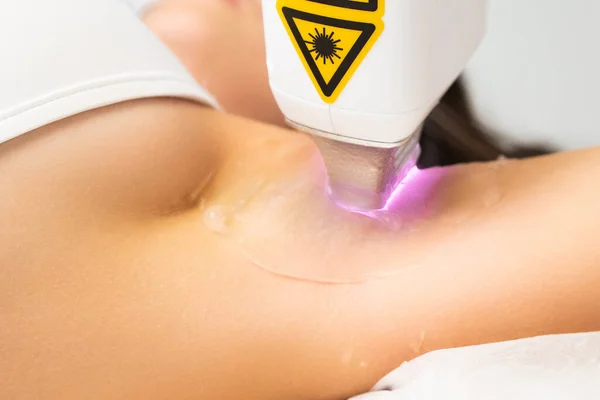 Laser hair removal in area of armpits of woman with modern device. Tracking work process of specialist in office concept. Use of appliance by professional