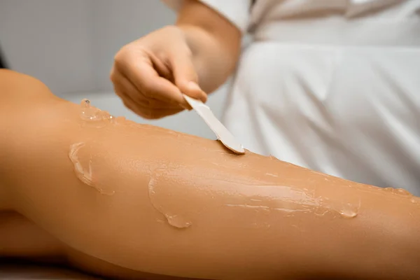 Kosmetologe Appliziert Gel Auf Das Weibliche Bein Vor Der Laserepilation — Stockfoto