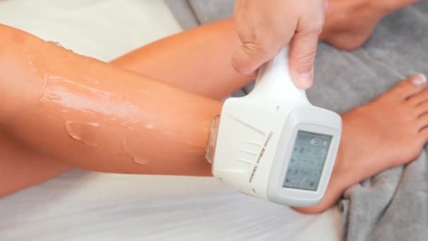 Uzman Ofisteki Bayan Müşteri Bacağında Lazer Tüy Temizleme Cihazı Çalıştırıyor — Stok video
