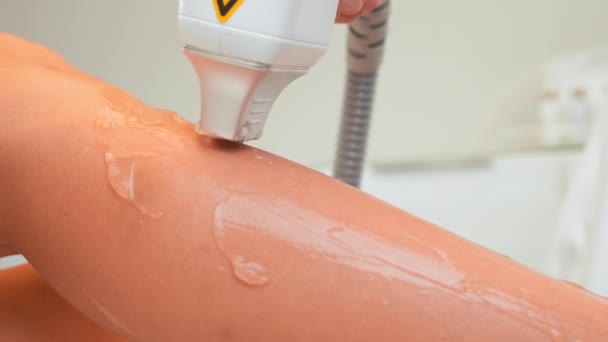 Ekspert Depiluje Laserowo Kobiecą Nogę Rozmazanym Woskiem Usuwanie Włosów Ciała — Wideo stockowe