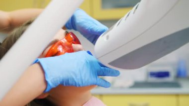Özel diş kliniğinde diş beyazlatma prosedürü. Ultraviyole ışıktan koruyucu gözlüklü kadın dişçinin beyazlatma prosedürüne hazır.