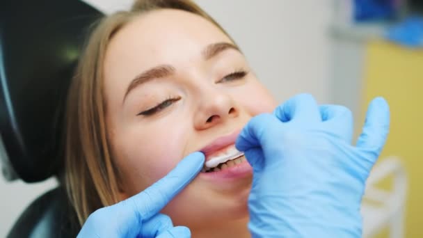 Diş Hekimi Beyazlatma Işleminden Sonra Dişlere Jel Sürmeyi Uygular Doktor — Stok video