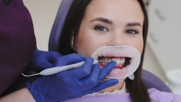 戴手套的牙科医生在诊所用仪器临时填牙 牙科专业人员用填充物填充牙缝 — 图库视频影像