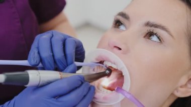 Diş hekimi, delme aletini kullanarak hasarlı diş bölgesini dikkatlice temizler. Muhalefet yapan genç bayan klinikte diş delme işlemi geçirdi.