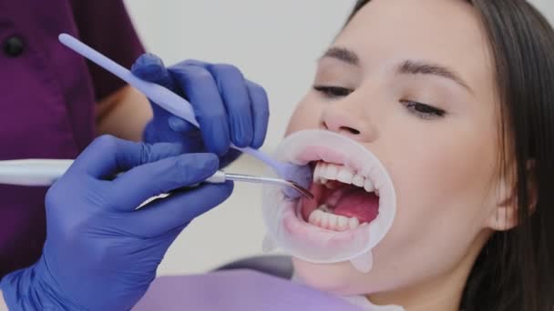 女牙医用唾液把空气吹遍牙齿干燥表面 以便进一步检查 牙科医生为口腔的牙科检查作准备 — 图库视频影像