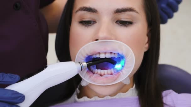 牙科医生在预约时间使用紫外光完成牙科填充物填充物的填充程序 紫外光导致牙科材料与牙釉质化学粘合 — 图库视频影像