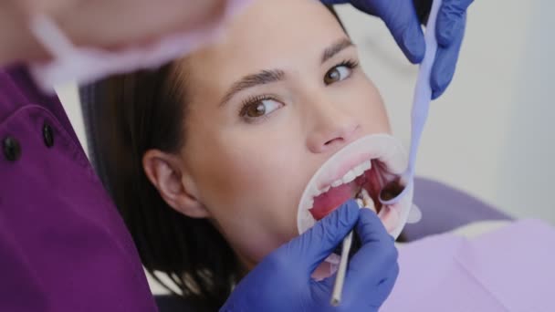 女性患者は病院で定期的な歯科検査を受けます マスクの熟練した歯科医は 予約時に歯科用具で上部歯の強さをチェックします — ストック動画