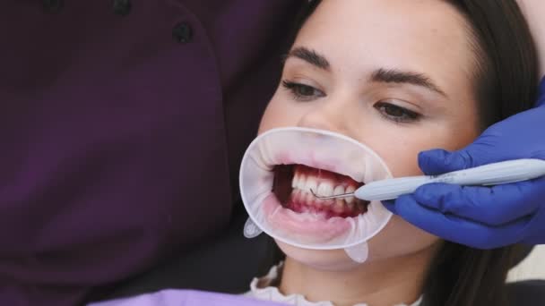 Dentista Luvas Coloca Enchimento Dental Temporário Com Ferramenta Dente Mulher — Vídeo de Stock