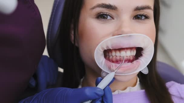 Specjalista Stomatolog Stosuje Materiał Wypełniający Powierzchni Zębów Pacjentki Pomocą Specjalistycznego — Wideo stockowe