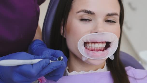 Tandläkare Förbereder Fyllnadsmaterial Tar Nödvändig Mängd Med Dentalsond Verktyg Tandfyllning — Stockvideo