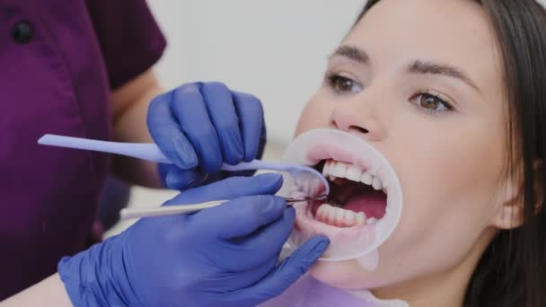환자는 진료소에서 치료를 받습니다 장갑을 의사는 장비를 사용하여 치아의 강도를 — 비디오