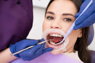 Kadın hasta klinikte diş tedavisi görüyor. Eldivenli kadın dişçi dişlerin gücünü titizlikle kontrol ediyor.