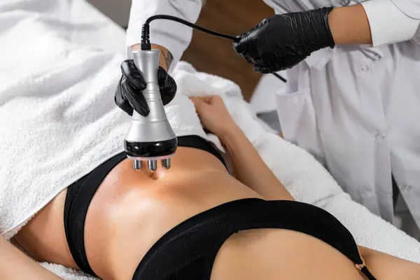 stock image A doctor does the Rf lifting procedure on the stomach to avoid overweight of a woman in a beauty salon. 