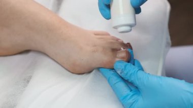 Antibiyotik tozu, ayak tırnaklarındaki mantar ve bakteriyel enfeksiyonların tedavisinde podolojist tarafından kullanılır.