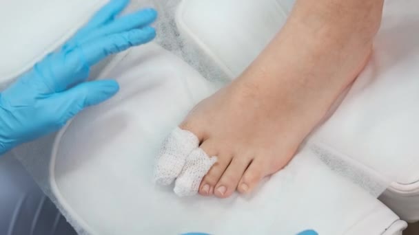 Подолог Використовує Пов Язку Нанесення Антисептика Ногу Після Видалення Нігтів — стокове відео