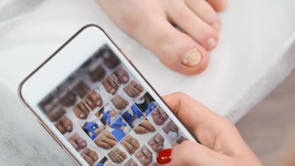 Nahaufnahme Eines Smartphones Mit Fotos Von Klienten Fußnägeln Den Händen — Stockvideo