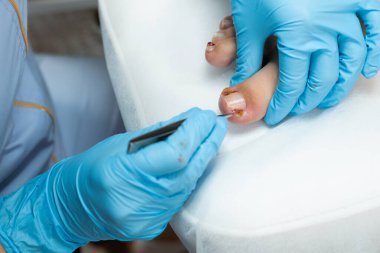 Podolojist güzellik salonunda tıbbi pedikür yapıyor.