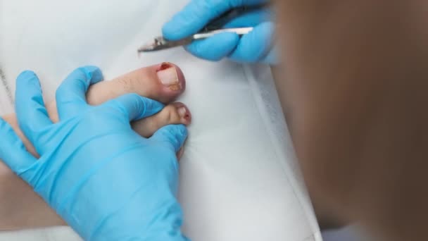 Podologe Blauen Gummihandschuhen Schneidet Der Klinik Nägel Mit Zangen Weiblichen — Stockvideo