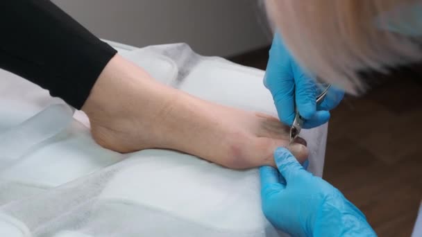 在诊所里 身穿蓝色橡胶手套的波德学家在女性脚趾上切下带有乳头的钉子 — 图库视频影像