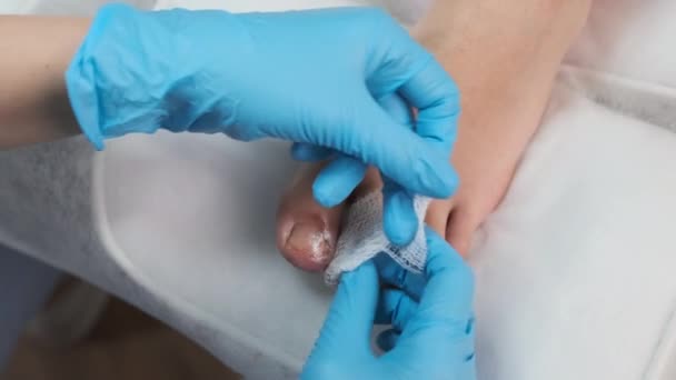 Close Bandaged Toes Patient Podiatrist Treatment — Stock Video