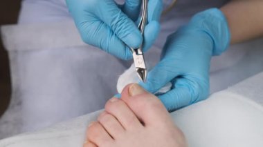 Podolojist tırnak makasıyla pedikür yapıyor.. 