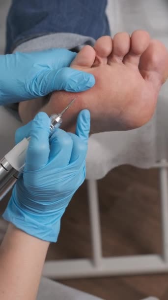 Close Podologist Using Electric Drill Woman Foot Remove Callus — Stok Video