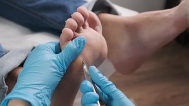 Kırpıcı kullanan bir ayak hastalıkları uzmanı tıp merkezindeki bir kadının ayağının nasırını kesiyor..