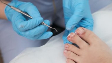 Podolojist güzellik salonunda tıbbi pedikür yapıyor.