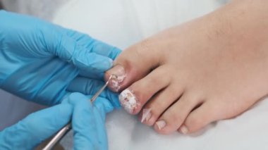 Podolojist tedaviden sonra kadın ayaklarının en üst görünümü. 