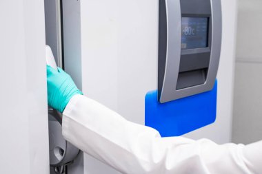 Kadın eli -80 C 'lik dondurucuyu numunelerle açıyor.. 