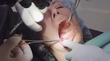 Diş hekimleri kadın hastaya dikiş attıktan sonra ince iplikler kesiyor. Modern klinik ortamlarda diş implantı prosedürünün tamamlanması