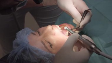 Diş implantı hazırlama ve sakız bölgesinde kullanılan cerrahi aletler. Diş ekibi odaklı ışıklandırma altında çalışırken hastanın ağzı açık.