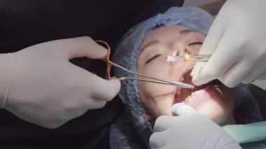 Doktor hasta ağzına dikiş atarken iplik ve dokuları kontrol etmek için cerrahi forseps kullanır. Asistan yaranın kapanması sırasında erişimi sürdürmeye yardımcı olur
