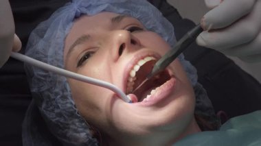 Diş hekimi hastaya oral ameliyat yaparken vakum aleti ve diş aynası kullanır. Cerrahi şapkalı, ağzı açık tedavi için bekleyen bir kadın.