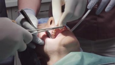 Profesyonel diş hekimleri diş ameliyatı sırasında yarayı dikmek için özel iplik kullanır. Modern kliniğe yerleştirme hazırlıklarının bir parçası.