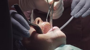 Doktor ameliyat sırasında vakum aletini kullanarak hastanın ağzını geniş ölçüde açar. Kadın çene sabit sabit diş tedavisi için açık erişim sağlar