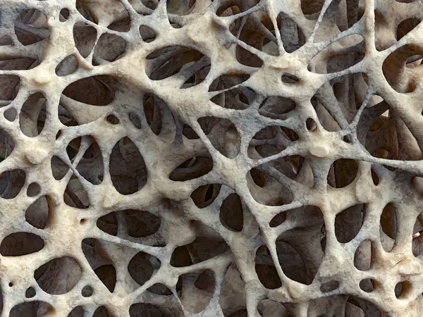 stock image Realistic bone spongy structure close-up, bone texture affected by osteoporosis, 3d illustration. Bone tissue damaged by osteoporosis