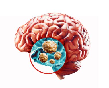 İnsan iç organının gerçekçi 3 boyutlu çiziminin anatomisi - beyin. İnsan beyninin röntgeni kanser için tarandı.
