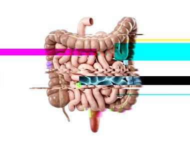 3d illustration of human internal organ intestine, failure concept clipart