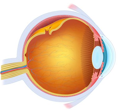 Retina yırtılması ile ilgili bir ilüzyon, retinanın koroidden ayrıldığı, görme kaybına neden olduğu ve acil tedavi gerektirdiği bir göz acil durumudur..