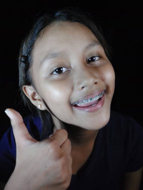 Diş telli Asyalı kız.