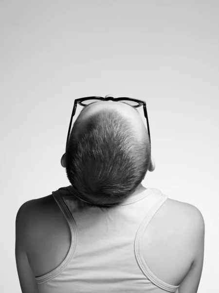 Schönes Mädchen Mit Kurzhaarschnitt Rücken Der Glatzköpfigen Frau Brille Schwarz — Stockfoto